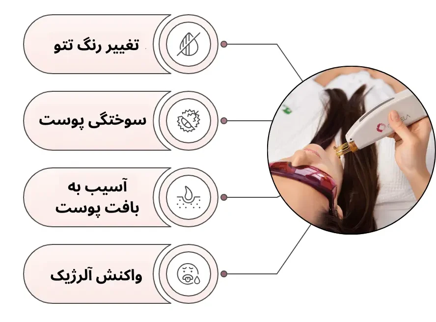 ممنوعیت لیزر روی نواحی تتو