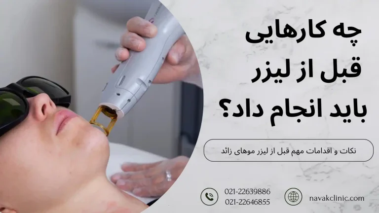 کارهایی که قبل از لیزر باید انجام داد